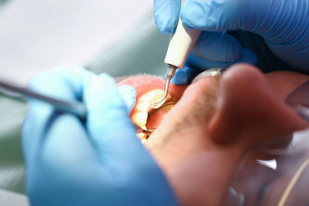 Best Emergency Gum Pain Relief  in Vassar, MI
